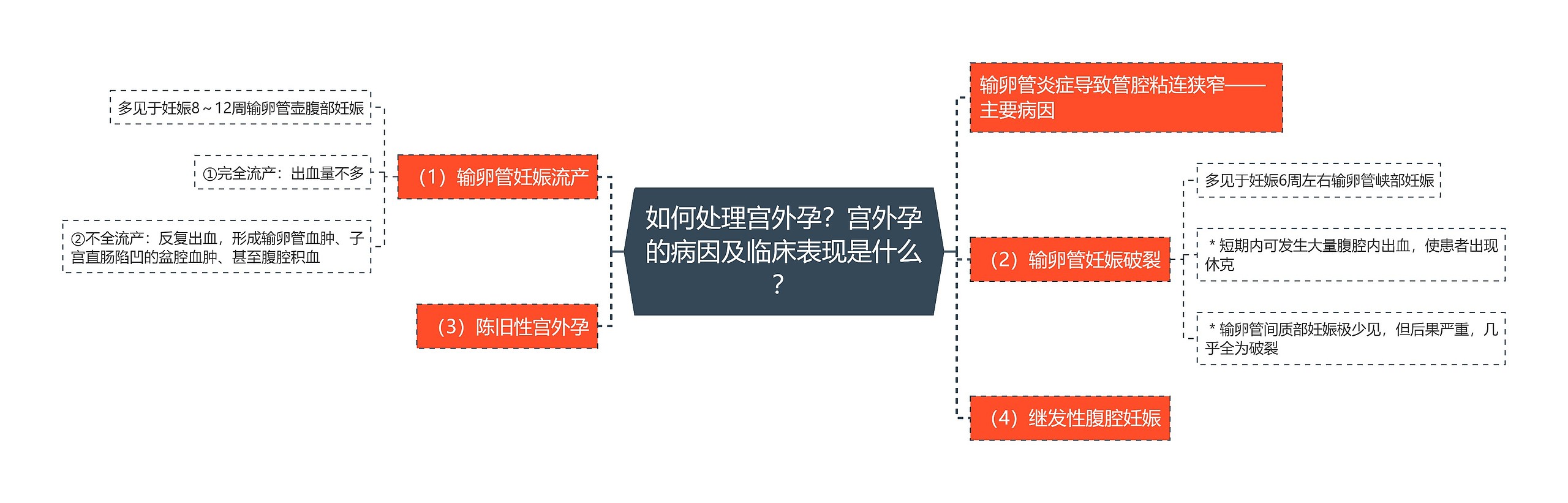 如何处理宫外孕？宫外孕的病因及临床表现是什么？思维导图