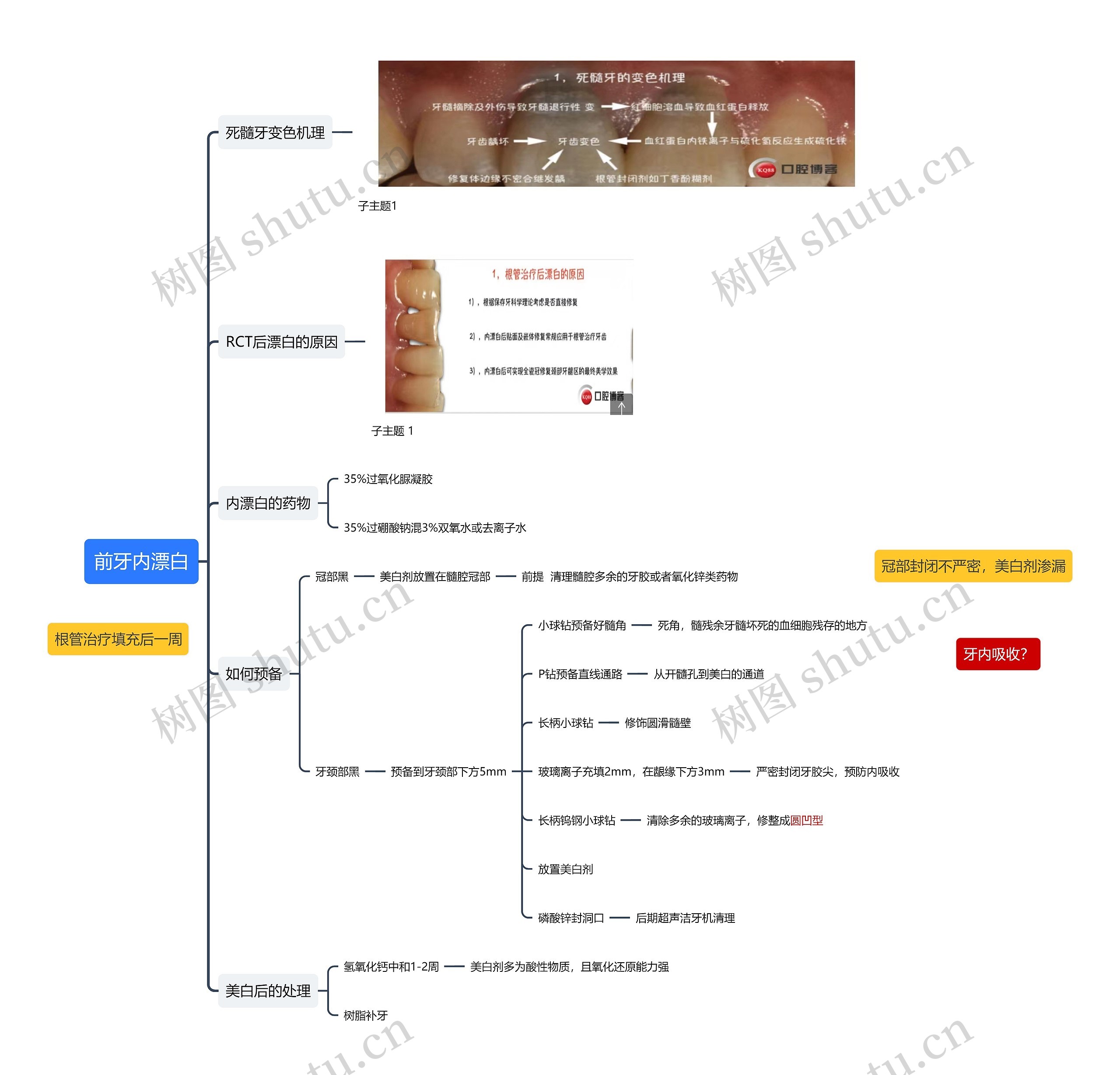 前牙内漂白思维导图