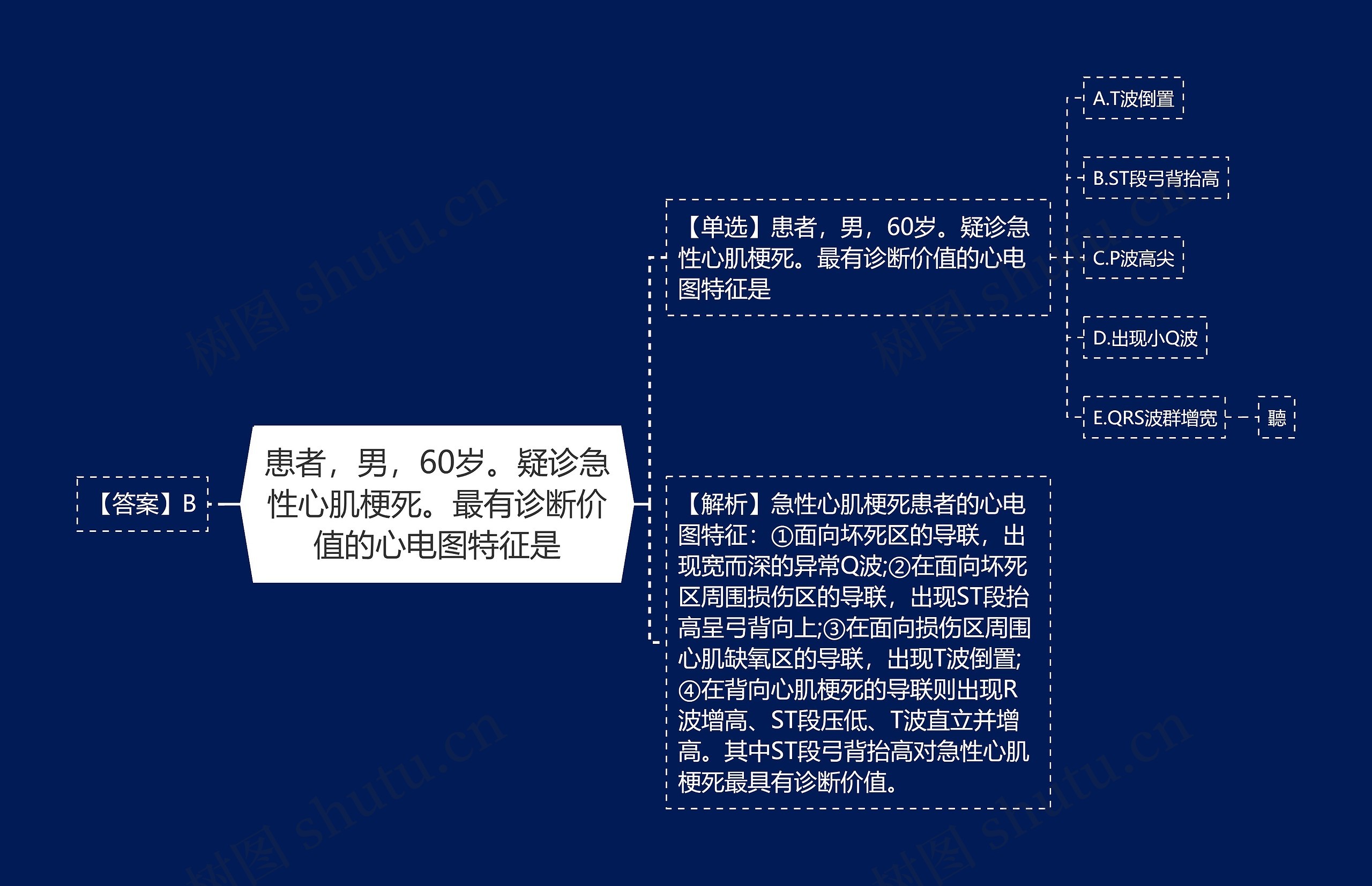 患者，男，60岁。疑诊急性心肌梗死。最有诊断价值的心电图特征是