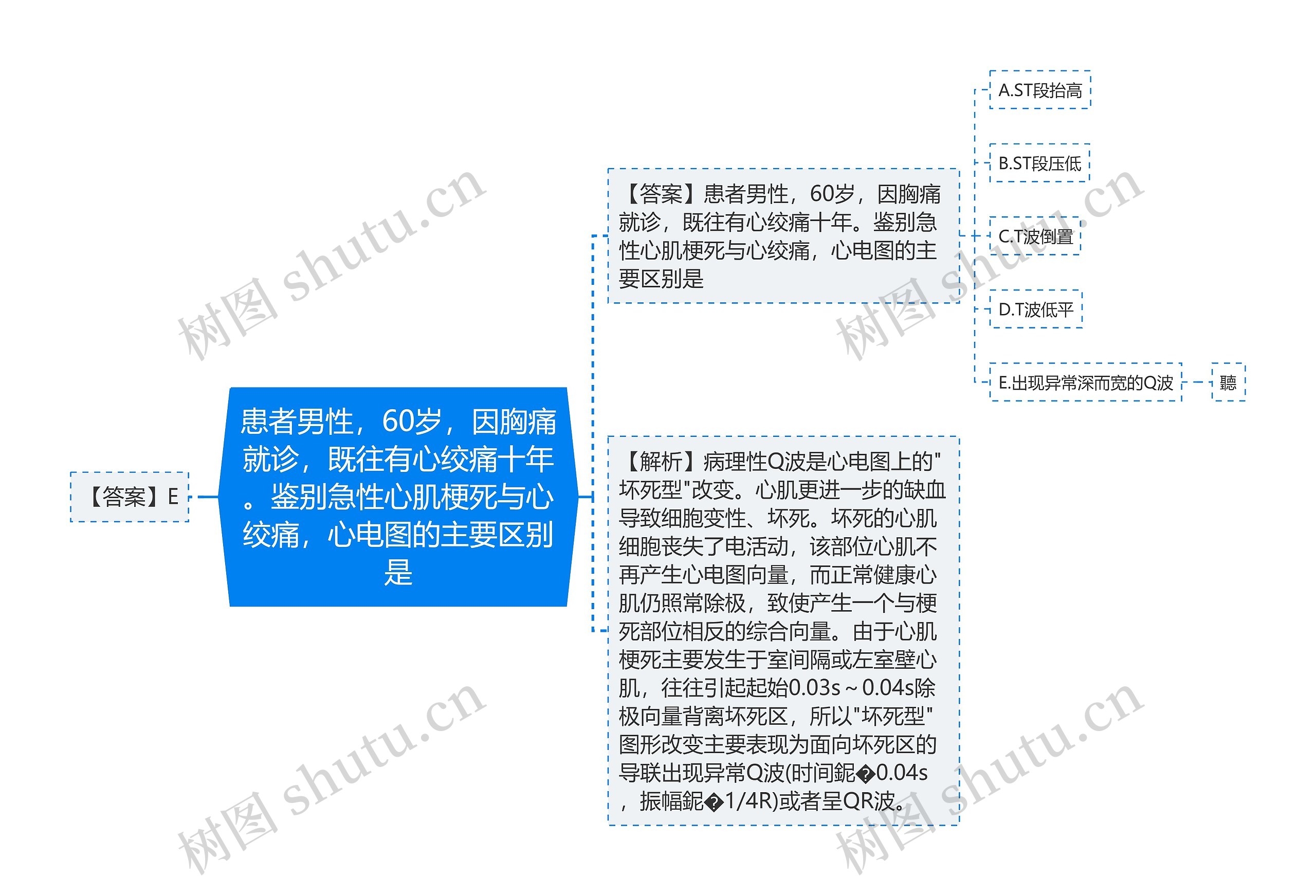 患者男性，60岁，因胸痛就诊，既往有心绞痛十年。鉴别急性心肌梗死与心绞痛，心电图的主要区别是