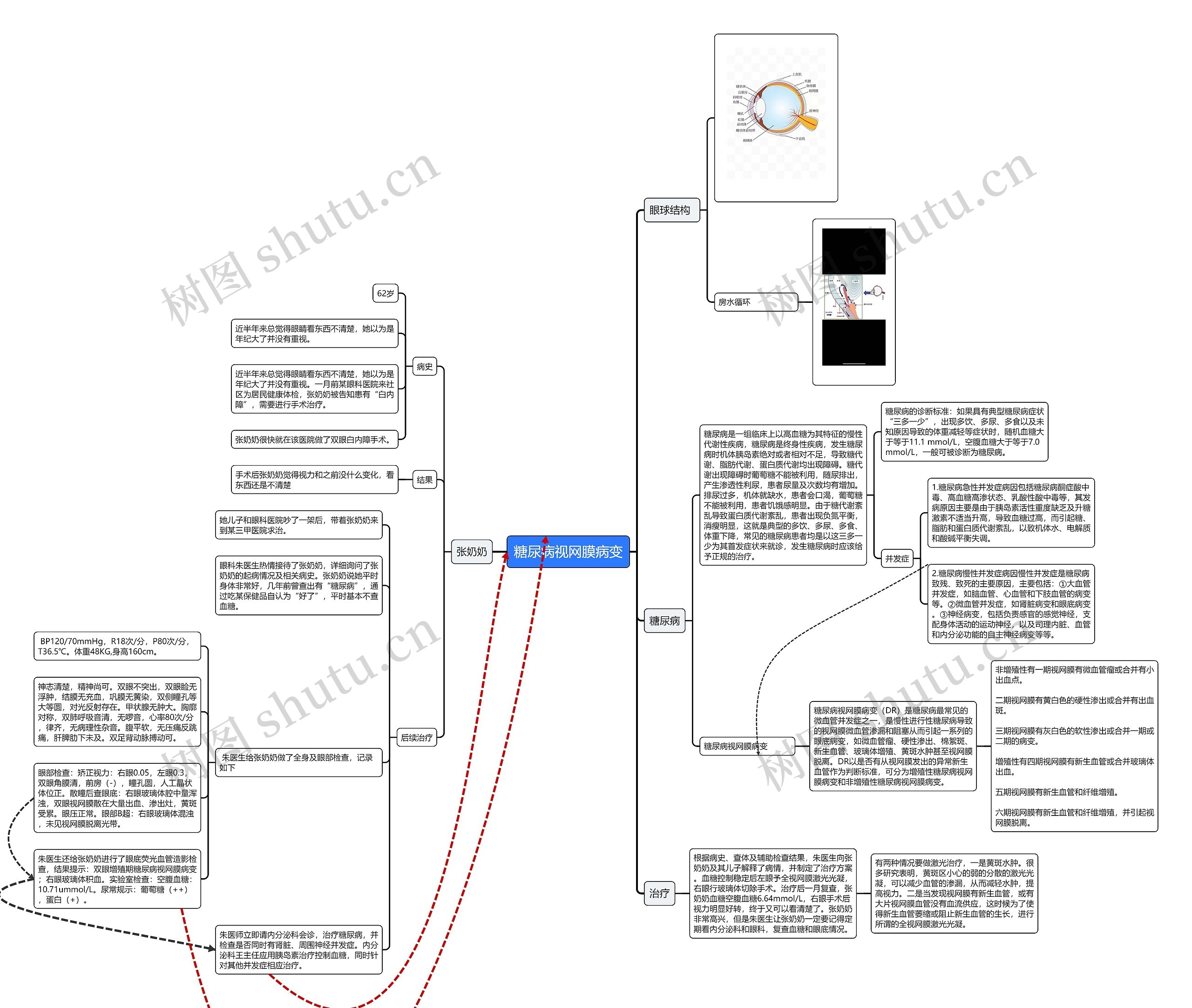 糖尿病视网膜病变思维导图