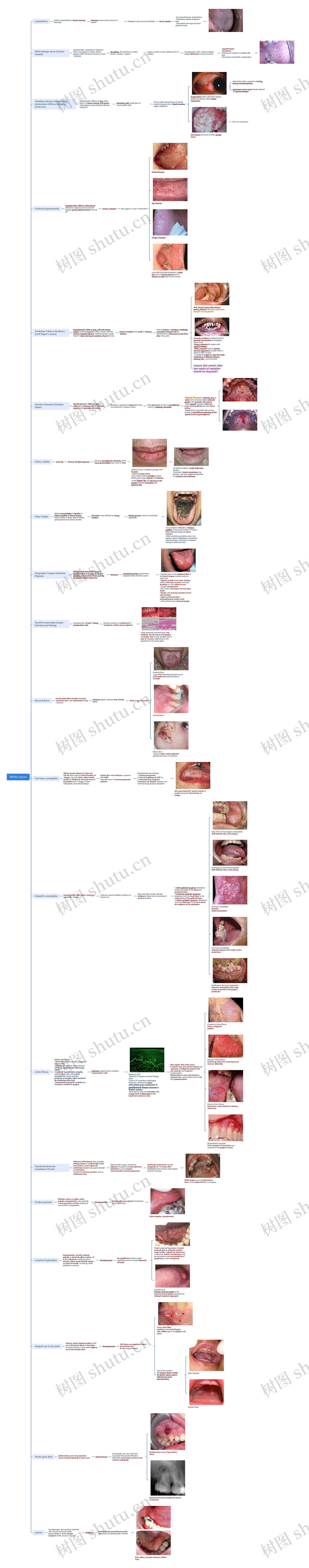 White Lesion思维导图
