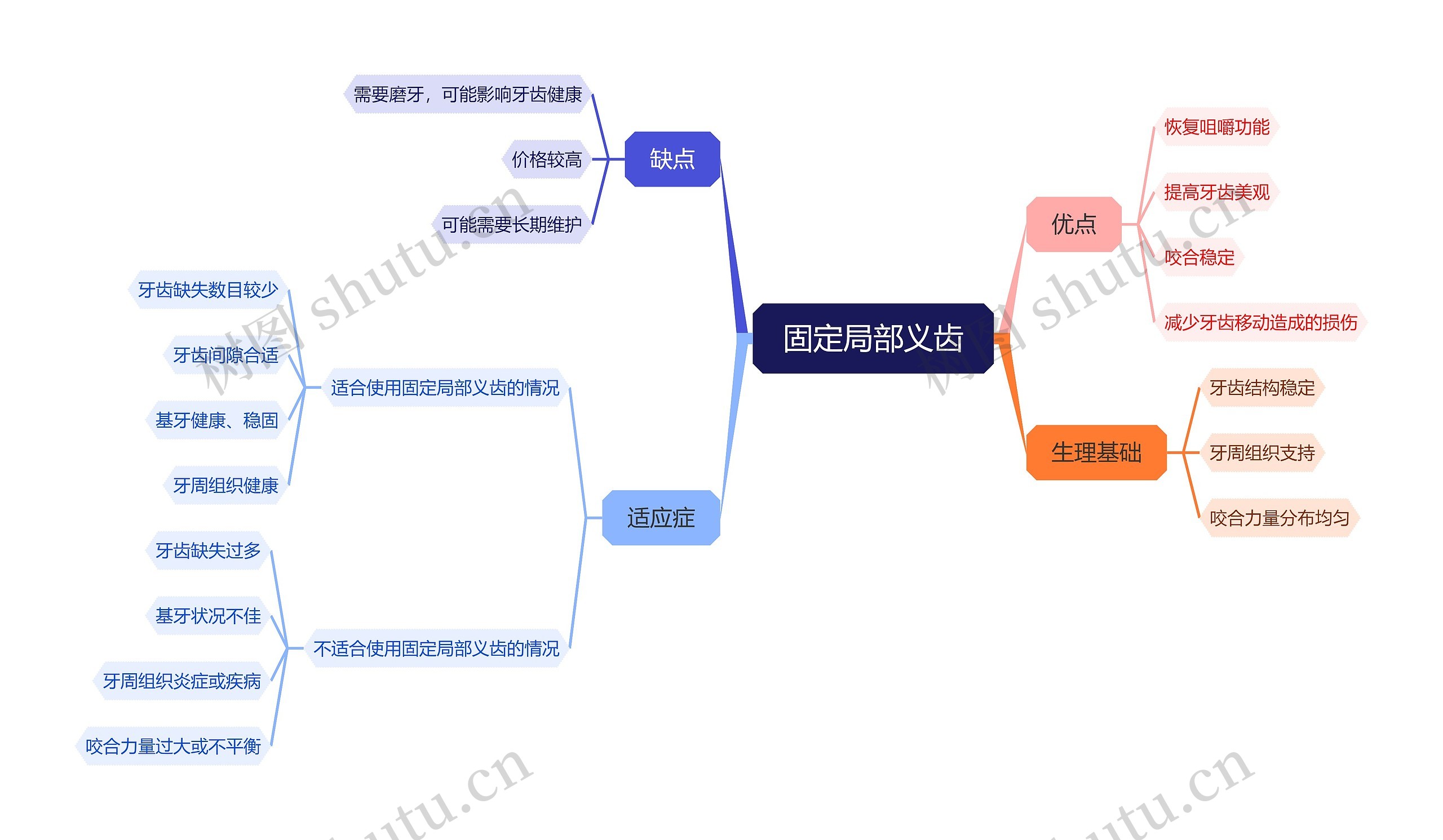 固定局部义齿